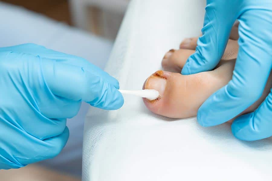 תמונה של פדיקור רפואי עד הבית בתל אביב – לטיפול בציפורן חודרנית  לקשישים ולחולי סוכרת